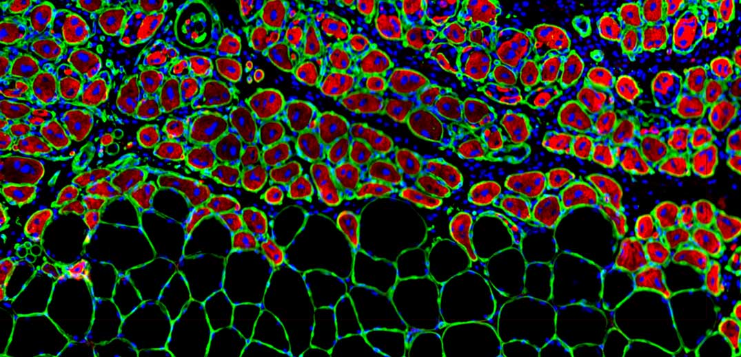 Cells